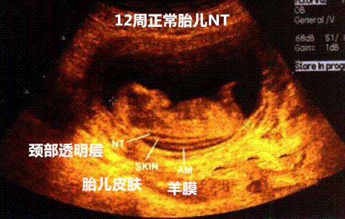 ��������,ʨ�����,